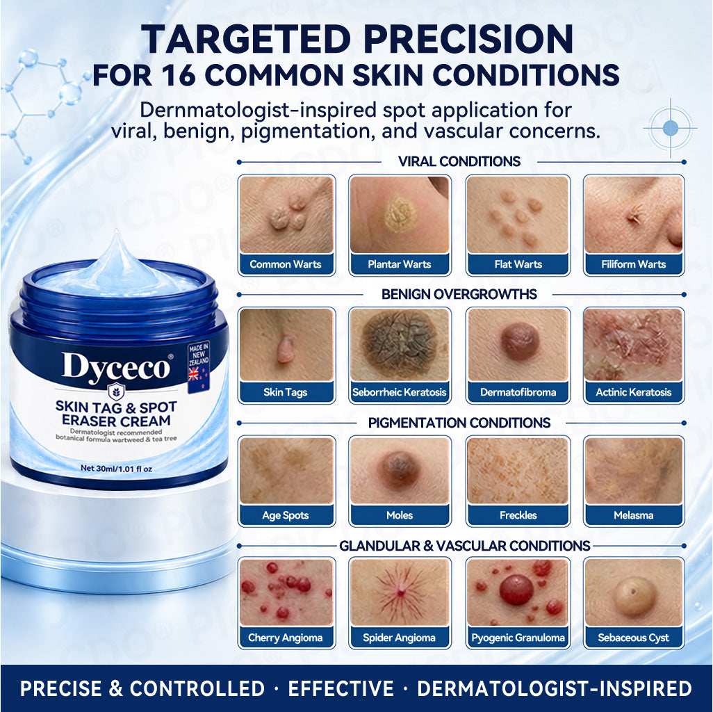 Dyceco® 🍒7-𝐃𝐚𝐲 𝐒𝐤𝐢𝐧 𝐓𝐚𝐠 & 𝐒𝐩𝐨𝐭 𝐄𝐫𝐚𝐬𝐞𝐫 𝐂𝐫𝐞𝐚𝐦 (Zero Pain, Zero 𝐒𝐜𝐚𝐫𝐬 Formula)