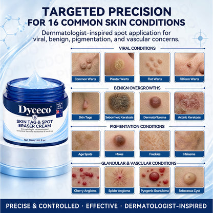 Dyceco® 🍒7-𝐃𝐚𝐲 𝐒𝐤𝐢𝐧 𝐓𝐚𝐠 & 𝐒𝐩𝐨𝐭 𝐄𝐫𝐚𝐬𝐞𝐫 𝐂𝐫𝐞𝐚𝐦 (Zero Pain, Zero 𝐒𝐜𝐚𝐫𝐬 Formula)