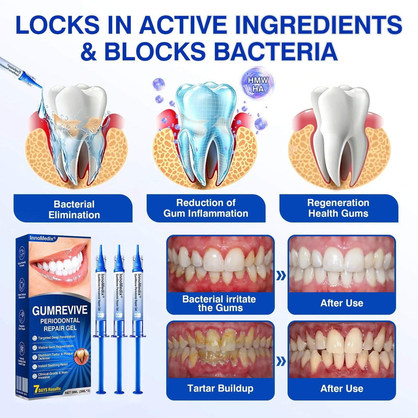 🇬🇧🏅🦷🛡️🍁InnoMedix® GumRevive Periodontal Repair Gel