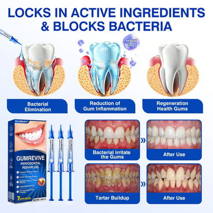 🇬🇧🏅🦷🛡️🍁InnoMedix® GumRevive Periodontal Repair Gel
