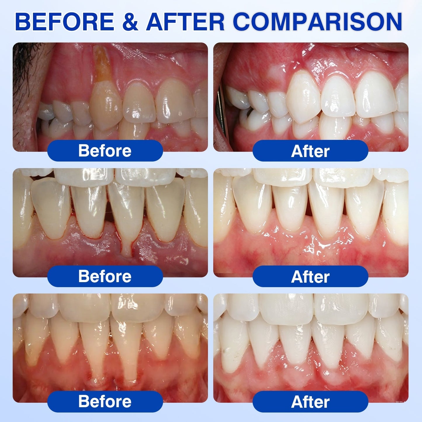 🇬🇧🏅🦷🛡️🍁InnoMedix® GumRevive Periodontal Repair Gel