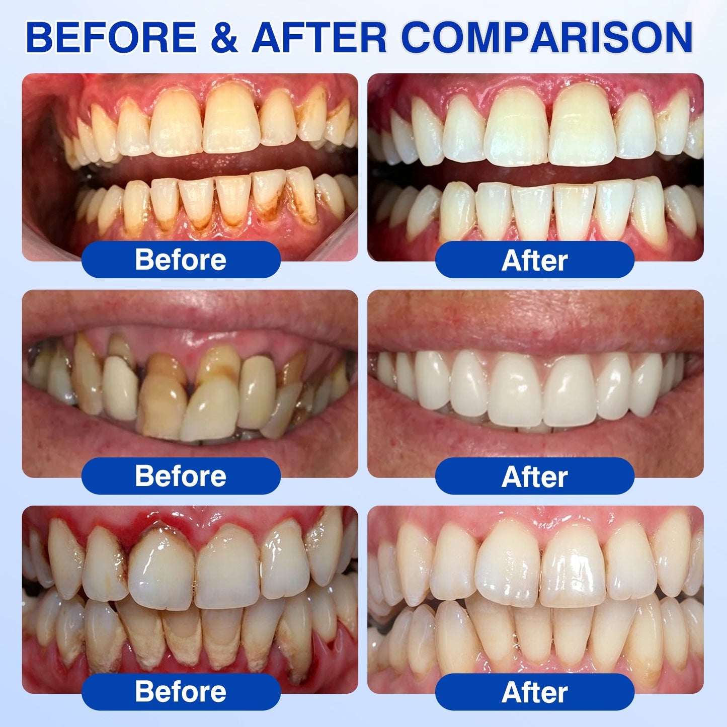 🇬🇧🏅🦷🛡️🍁InnoMedix® GumRevive Periodontal Repair Gel