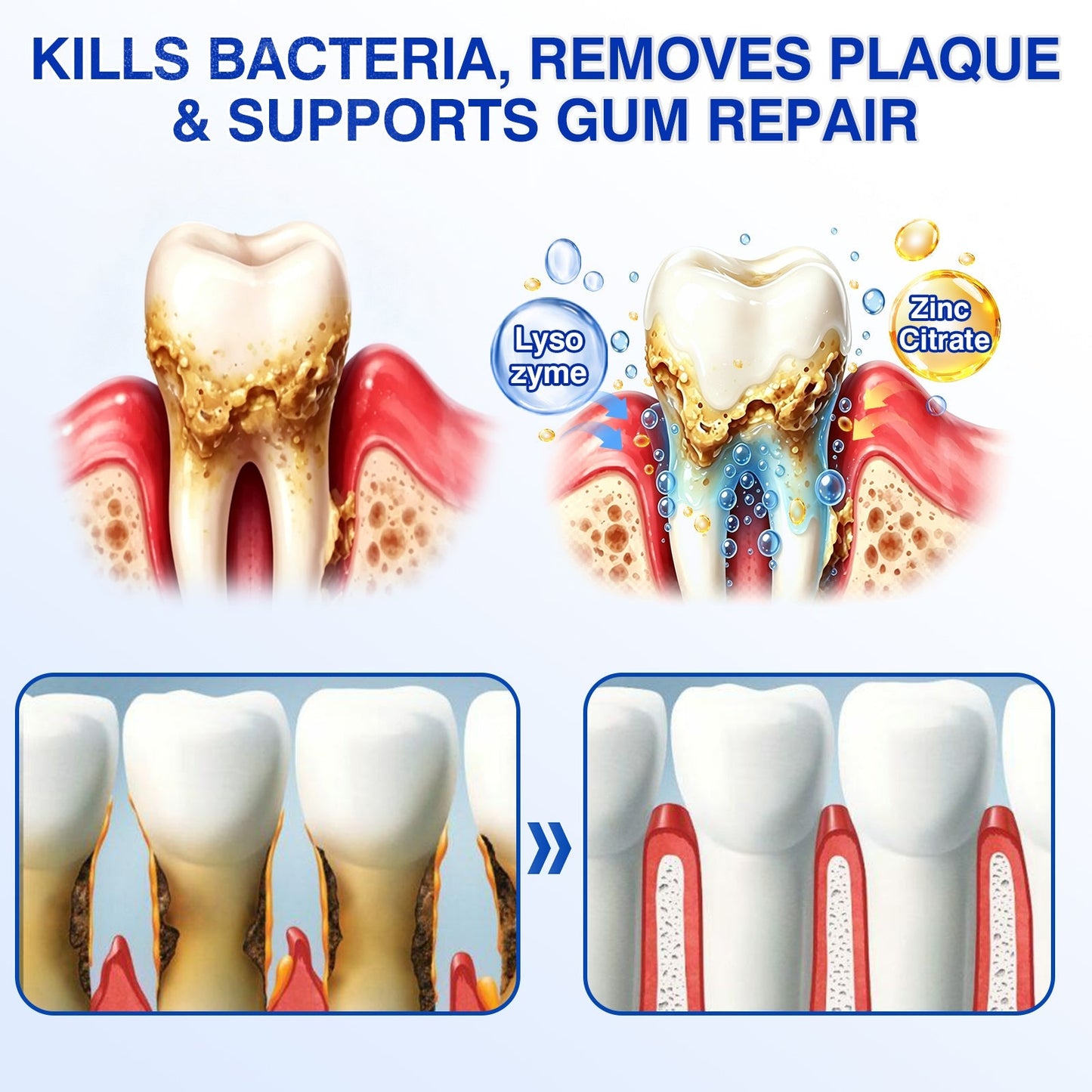 🇬🇧🏅🦷🛡️🍁InnoMedix® GumRevive Periodontal Repair Gel